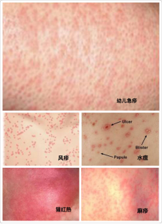 汽车点火系统故障案例分析_汽车点火系统故障_车辆点火系统故障