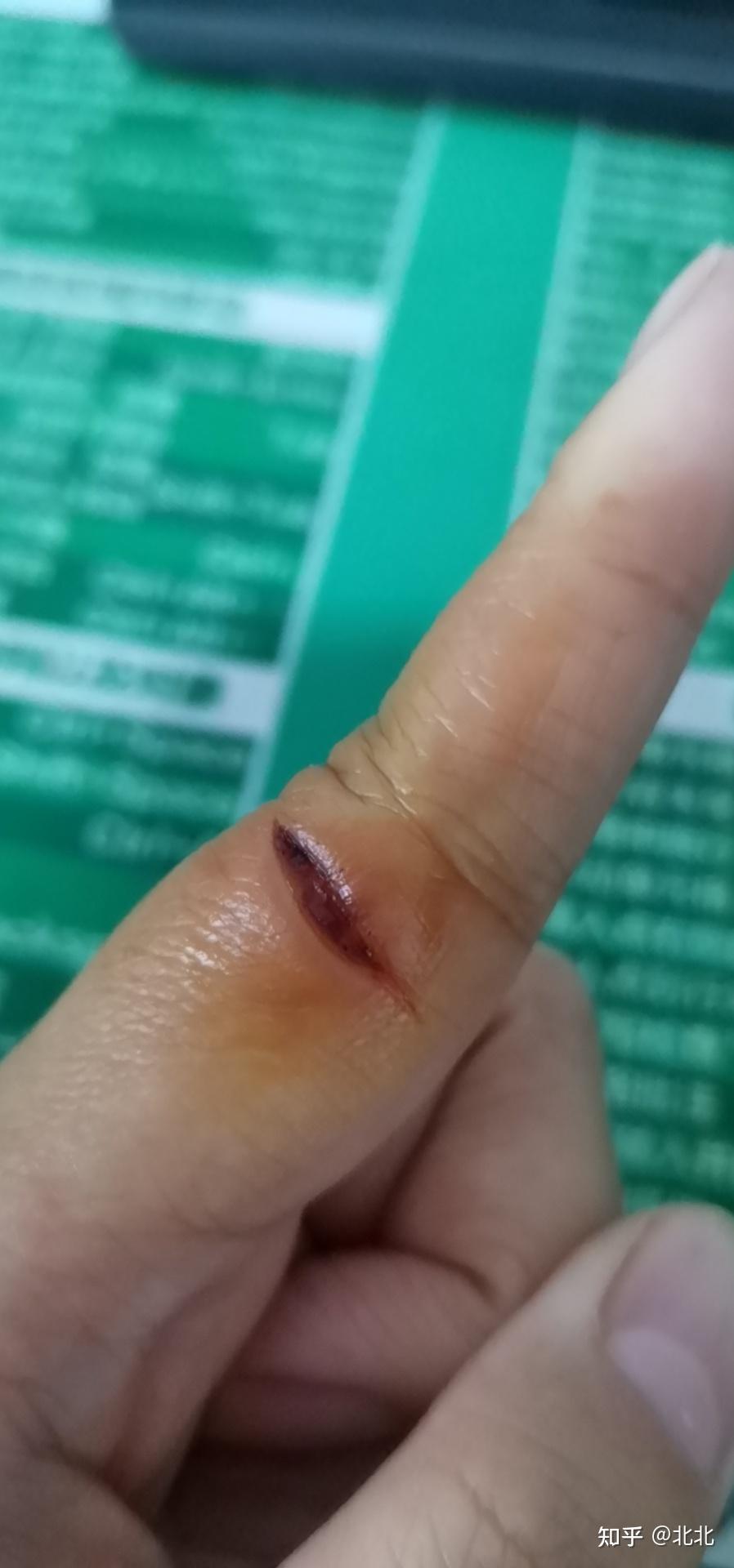 施肥器厂家_施肥器价格_施肥器价格及图片